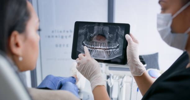 Licensed Tooth Extraction service in Summerville, SC - Smile Center Dentistry